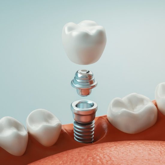 Dentist in Topeka