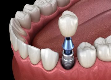 Dentist in Topeka