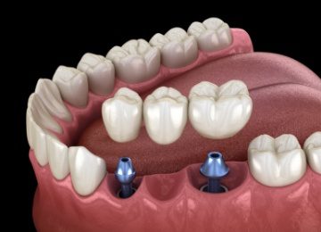 Dentist in Topeka