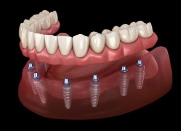 Dentist in Topeka
